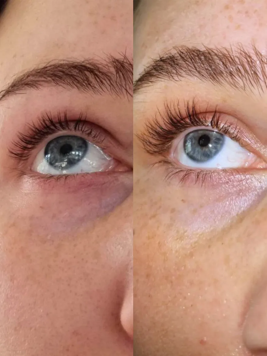 Εικόνα της EYELASH GROWTH SERUM 5ml