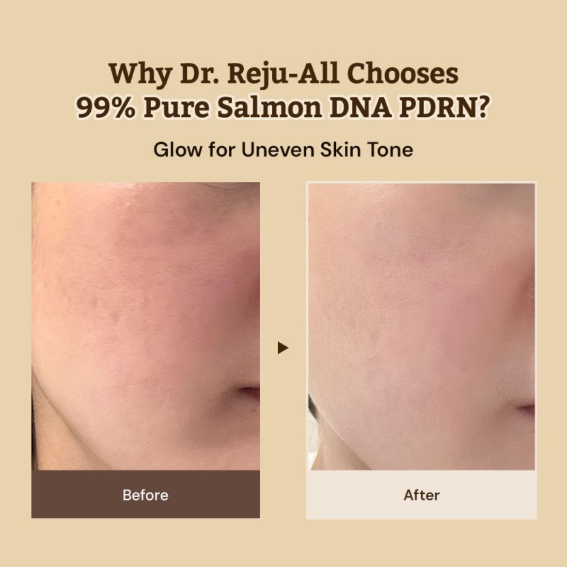 Εικόνα της Dr.Reju-All Advanced PDRN Rejuvenating Cream- Kρέμα επανόρθωσης με PDRN
