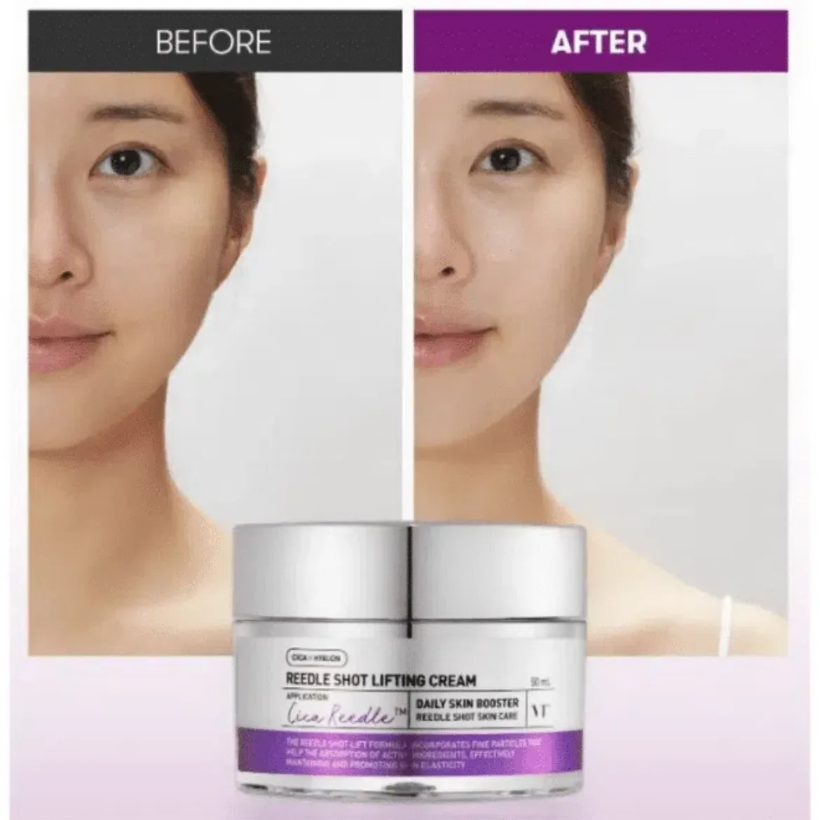 Εικόνα της VT Cosmetics Reedle Shot Lifting Cream 50ml